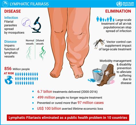 Nepal Govt Launches Common Medicine Program to Combat Lymphatic Filariasis Disease in 15 ...