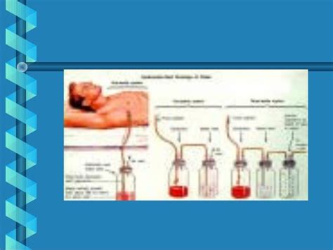 2. chest tube drainage