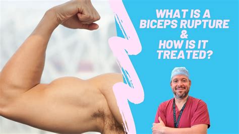 What is a biceps rupture and how is it treated? - YouTube