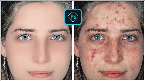 How to Remove face Pimples in Photoshop in Photoshop Retouching Tutorial - YouTube