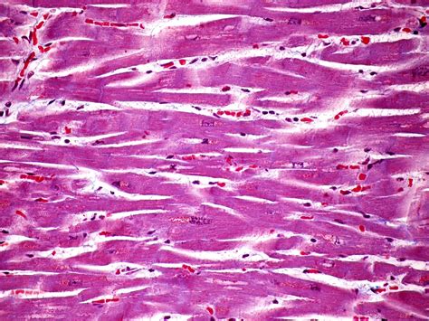 SOS BIOLOGIA CELULAR Y TISULAR: TEJIDOS. MUSCULAR