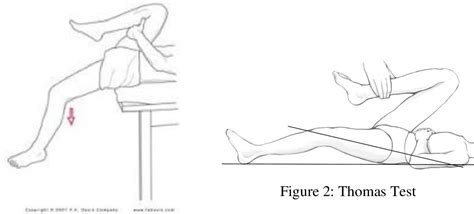 Hip Flexor Extensibility and Its Correlation to Hip Hyperextension and Lower Back Pain in ...