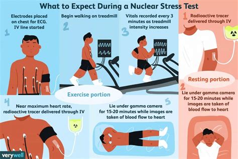 What Is a Nuclear Stress Test? - THW Cardiology Center in Thornhill