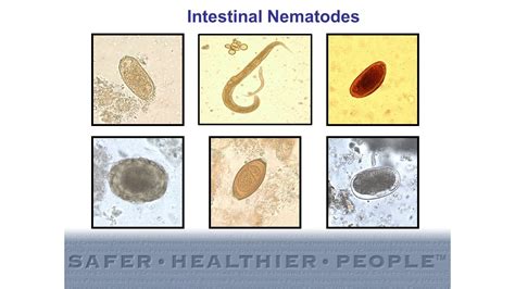 Diagnostic Features of Intestinal Nematodes - YouTube