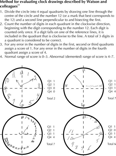 Moca test score interpretation - tereon