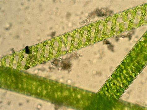 Spirogyra: Structure & Characteristics with Labeled Diagram