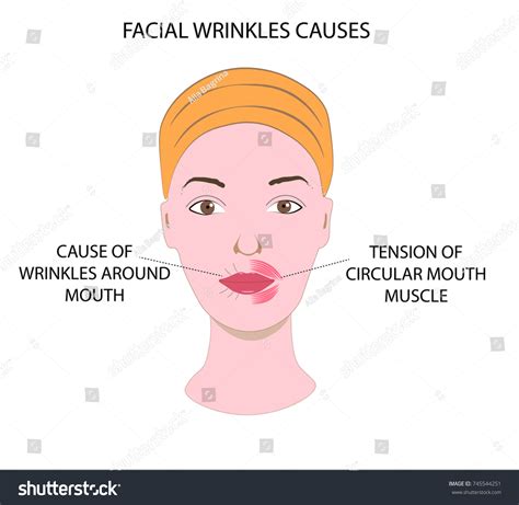 Womans Face Demonstrating Causes Facial Wrinkles Stock Vector (Royalty ...