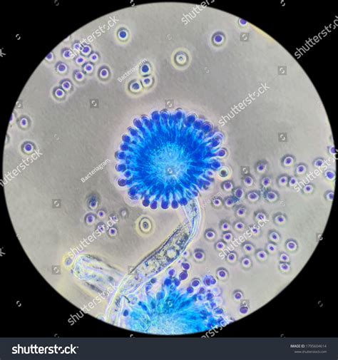 Aspergillus Flavus Fungal Phase Contrast Microscopy Stock Photo 1795604614 | Shutterstock