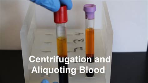 Centrifugation and Aliquoting of Blood Serum and Plasma - YouTube