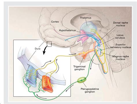 Figure 1-2 from Migraine Diagnosis and Pathophysiology | Semantic Scholar