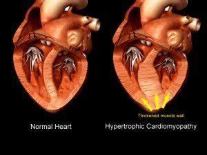 Hypertrophic Cardiomyopathy in Cats | Texas West Animal Health