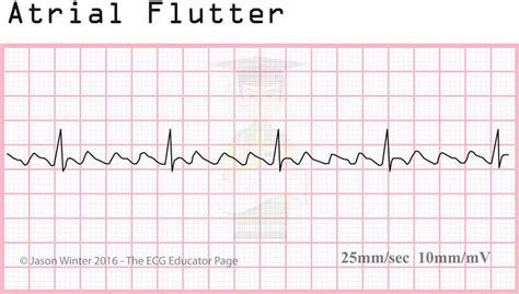 Pin by Jessica Byers on School, AHHHHH! | Education, Rhythms, Ekg rhythms