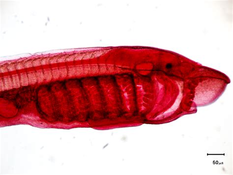 Lamprey Diagram | Quizlet