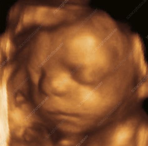 Foetus at 26 weeks, 3-D ultrasound scan - Stock Image - C003/4222 - Science Photo Library