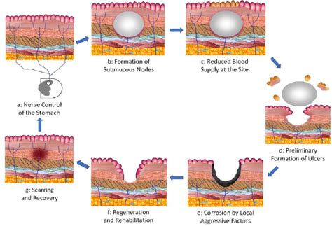 The pathological process of gastric ulceration. (a) The activities and ...