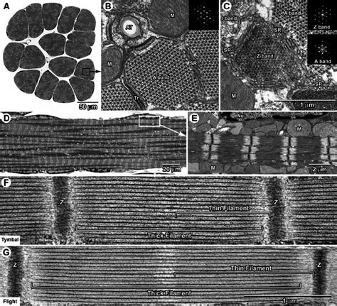 Tymbal and flight muscles. Light ( A and D ) and electron micrographs... | Download Scientific ...