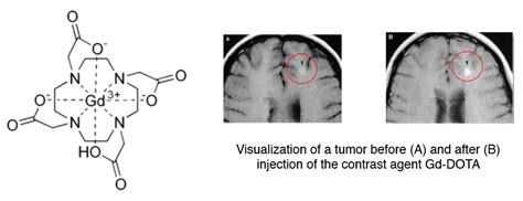 Imaging contrast agents - www.chematech-mdt.com