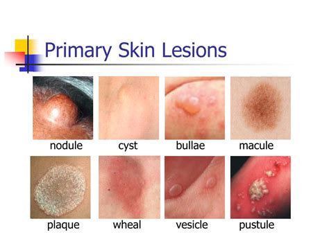 PPT - Non-Infectious Skin Diseases PowerPoint Presentation, free ...