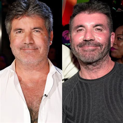 SIMON COWELL PLASTIC SURGERY: HAS SIMON COWELL UNDERGONE PLASTIC SURGERY? – BeautyPg