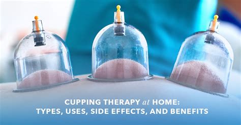 Cupping Therapy at Home: Types, Uses, Side Effects, and Benefits