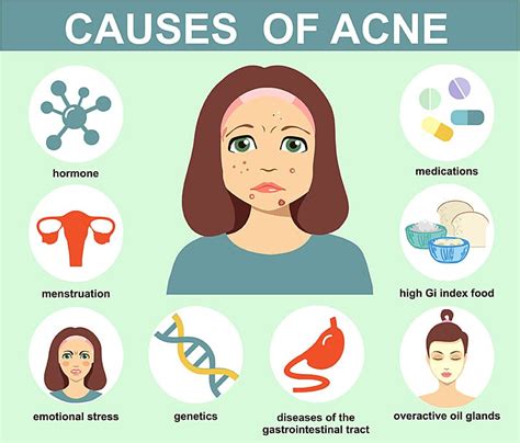 What Causes Cystic Acne And How To Treat It Effectively | SL Aesthetic Clinic