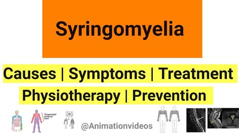 What is Syringomyelia | Pathophysiology | Symptoms | Physiotherapy ...