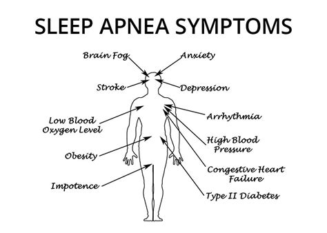 Causes and Symptoms of Sleep Apnea – Nashua, NH – Hollis, NH