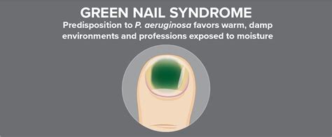 Pseudomonas aeruginosa Test for Green Nail Syndrome - Bako Diagnostics