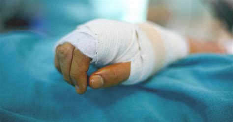 Degloving: Images, Types, Treatment, and Complications