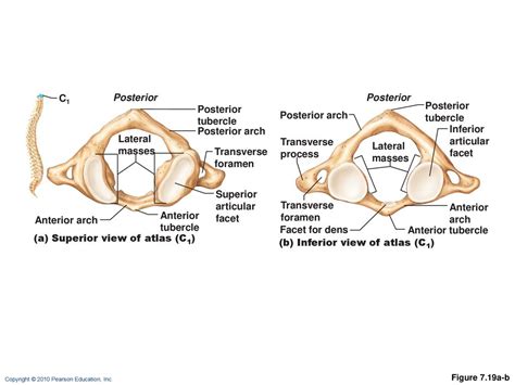 Vertebral Column Transmits weight of trunk to lower limbs - ppt download