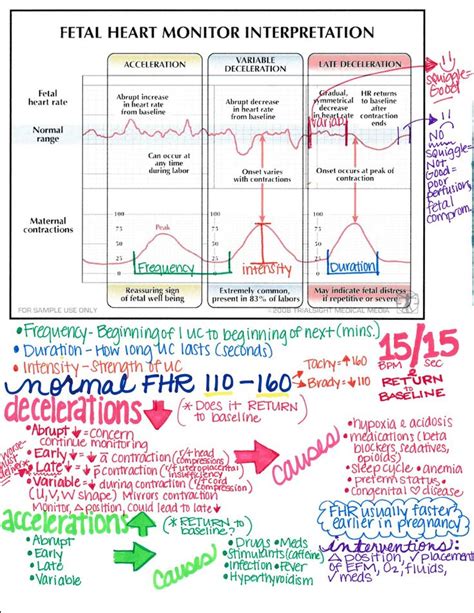 Fetal heart monitor interpretation nursing | Nursing school tips, Nursing school survival ...