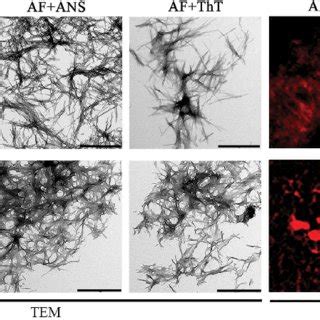 Morphology and staining by fluorescent probes of amyloid fibrils formed... | Download Scientific ...