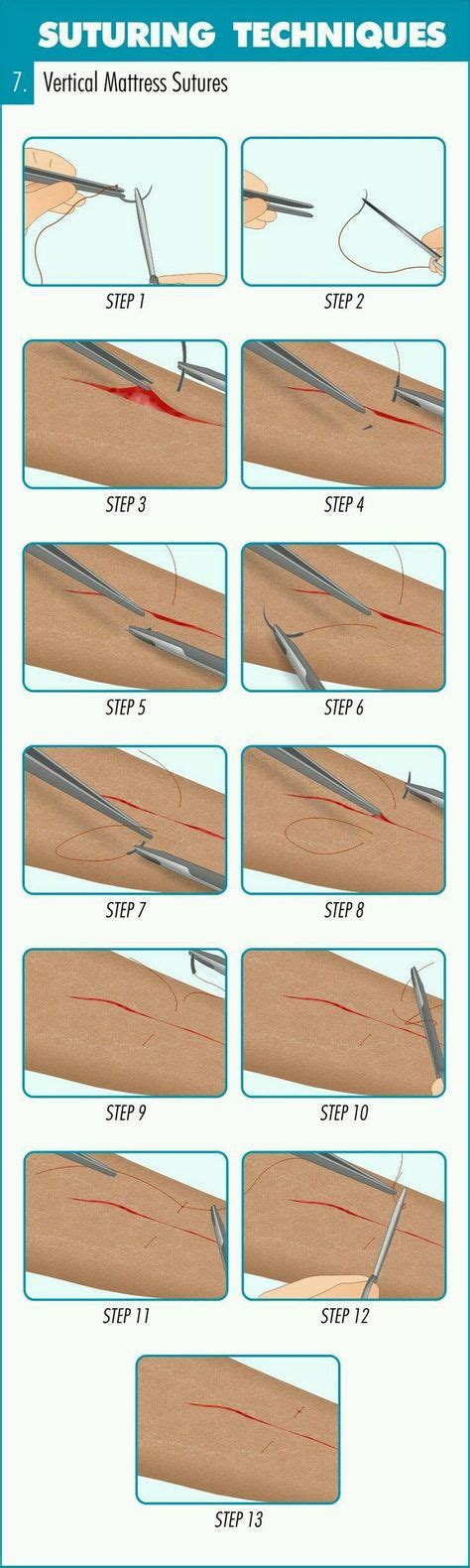 11 Best Suture methods images | Medical, Emergency medicine, Surgical tech