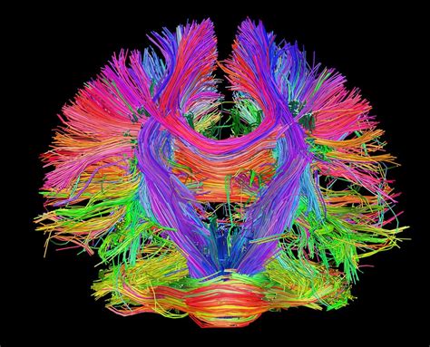 guff.com | Human brain, Brain art, Brain images