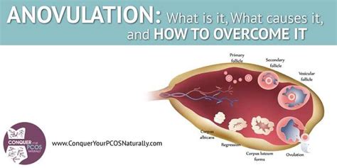 Anovulation: How To Overcome It | Conquer Your PCOS Naturally