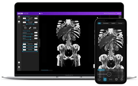 3D DICOM Viewer for iOS - iPhone & iPad DICOM Viewer App