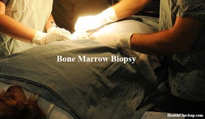 Bone Marrow Biopsy Test Procedure & Results| Health Checkup