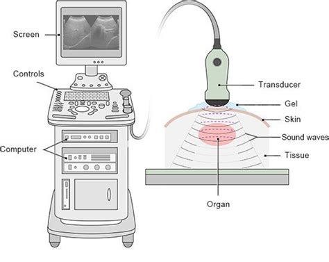 How do ultrasound examinations work? | informedhealth.org