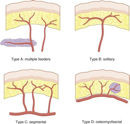 Classification of Flaps | Plastic Surgery Key