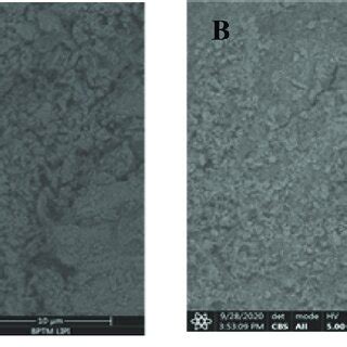 Rietveld refinement calculation of limonite and saprolite ore ...