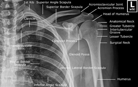 Shoulder girdle radiograph | Medical anatomy, Radiology student, Diagnostic imaging