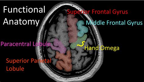 Mri Brain Anatomy