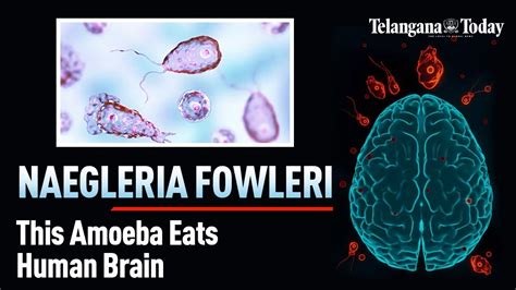 Naegleria Fowleri: The Brain-Eating Amoeba - Explained | Symptoms, Prevention, And Recent Cases ...