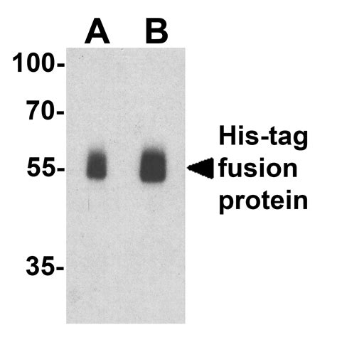 His-tag Antibody - Cat. No. 7877 | ProSci