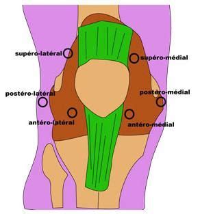 Knee Arthroscopy - Approaches | Knee arthroscopy, Knee arthroplasty, Medical knowledge