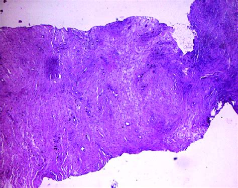 Histological photo shows the reduction of inflammatory cells compared... | Download Scientific ...