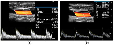 Diagnostics | Free Full-Text | Quantitative Blood Flow Measurements in ...