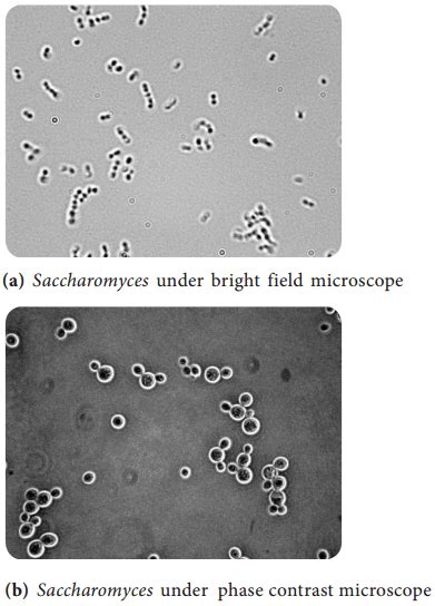 Phase Contrast Microscope – Definition, Principle, Parts, Uses