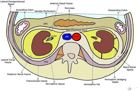 Perirenal space | Radiology Reference Article | Radiopaedia.org ...