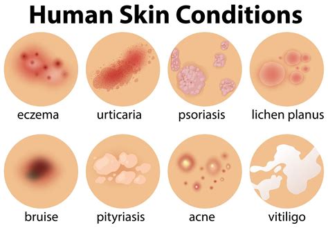 A Set of Human Skin Conditions 300507 Vector Art at Vecteezy